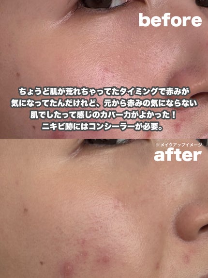 ã¢ã³ãªãããã ã±ã¢ ã〠ã»ã©ã ãã¡ã³ããŒã·ã§ã³/shu uemura/ãªããããã¡ã³ããŒã·ã§ã³ã䜿ã£ãã¯ãã³ãïŒ5æç®ïŒ