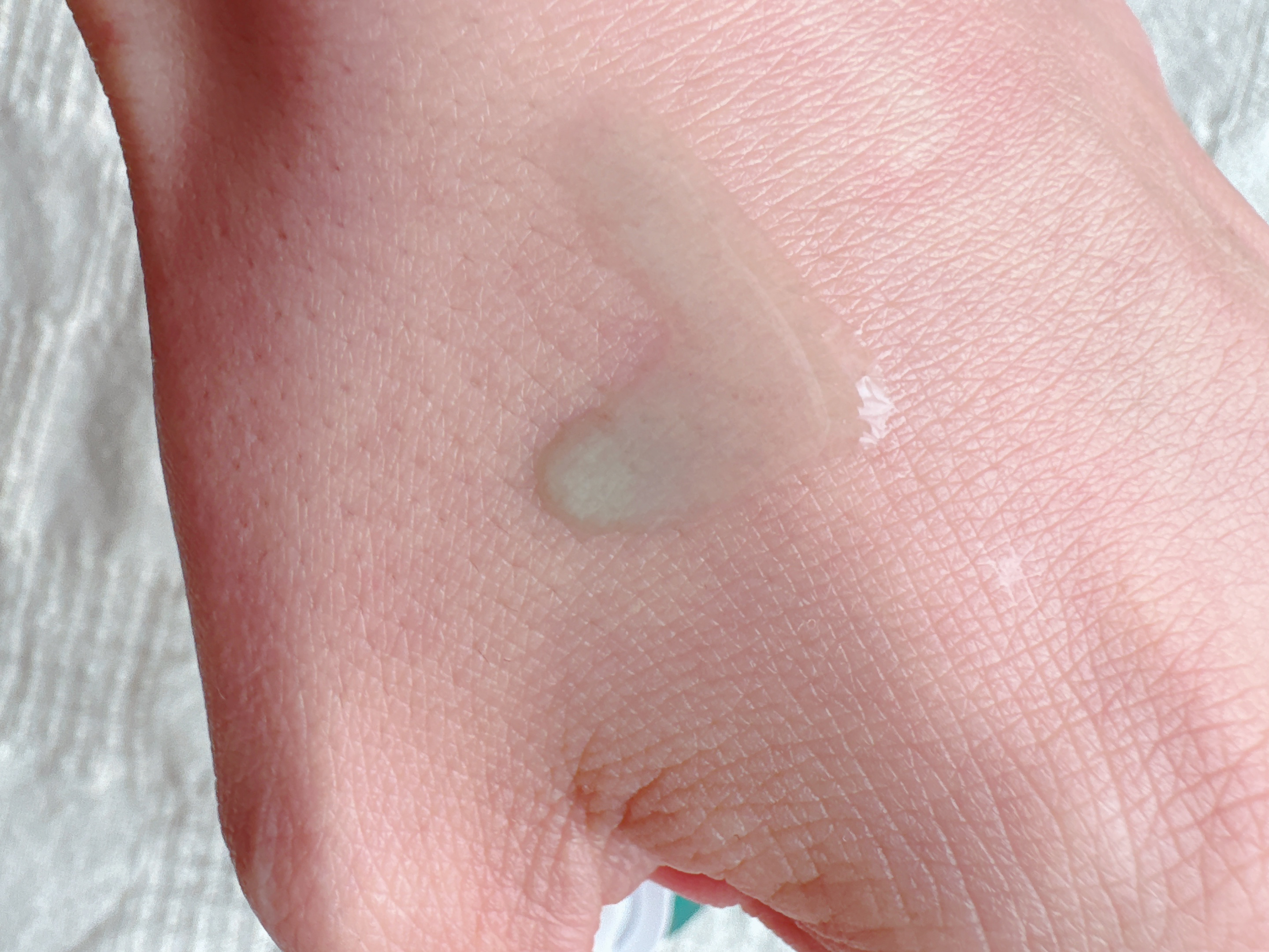 アゼライン酸16BBスージングセラム/MEDICUBE/美容液を使ったクチコミ（3枚目）