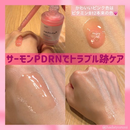 PDRNピンクアンプル PDRN 10,000ppm配合/MEDICUBE/美容液を使ったクチコミ(2枚目)