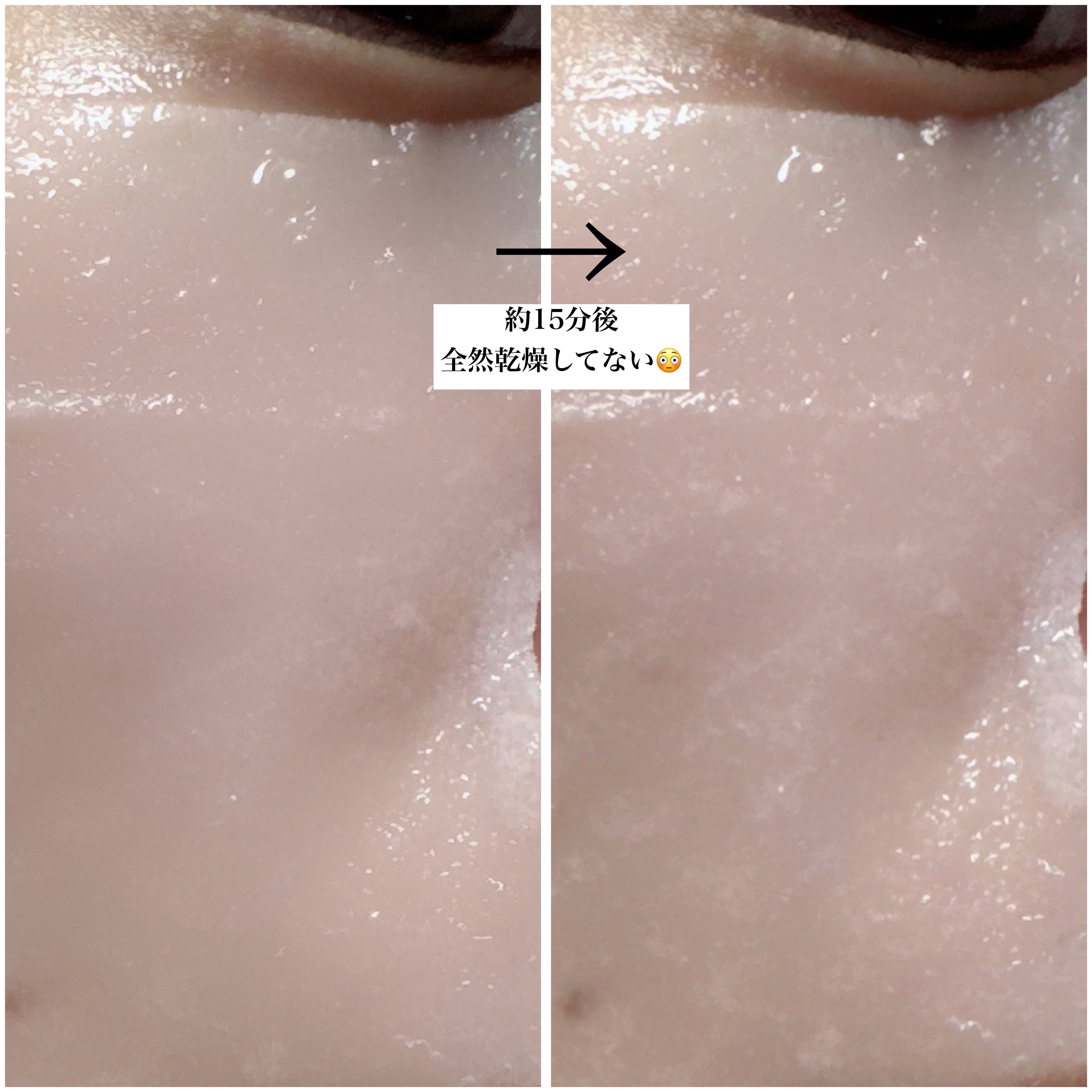 PHセンシティブマスクスージング＆モイスト/SAM&#39;U/シートマスク・パックを使ったクチコミ（3枚目）