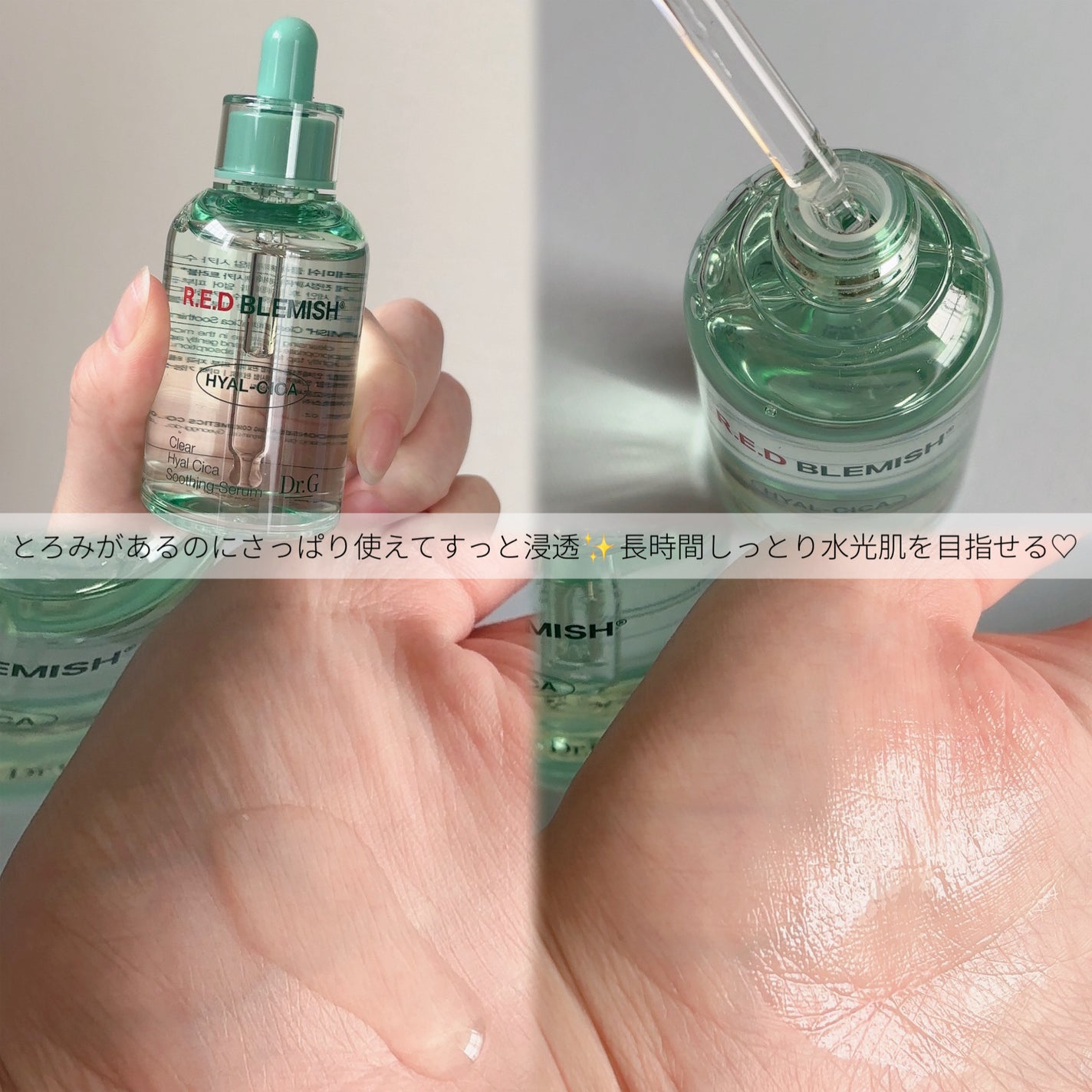 レッドブレミッシュ クリアスージングクリーム/Dr.G/フェイスクリームを使ったクチコミ(5枚目)
