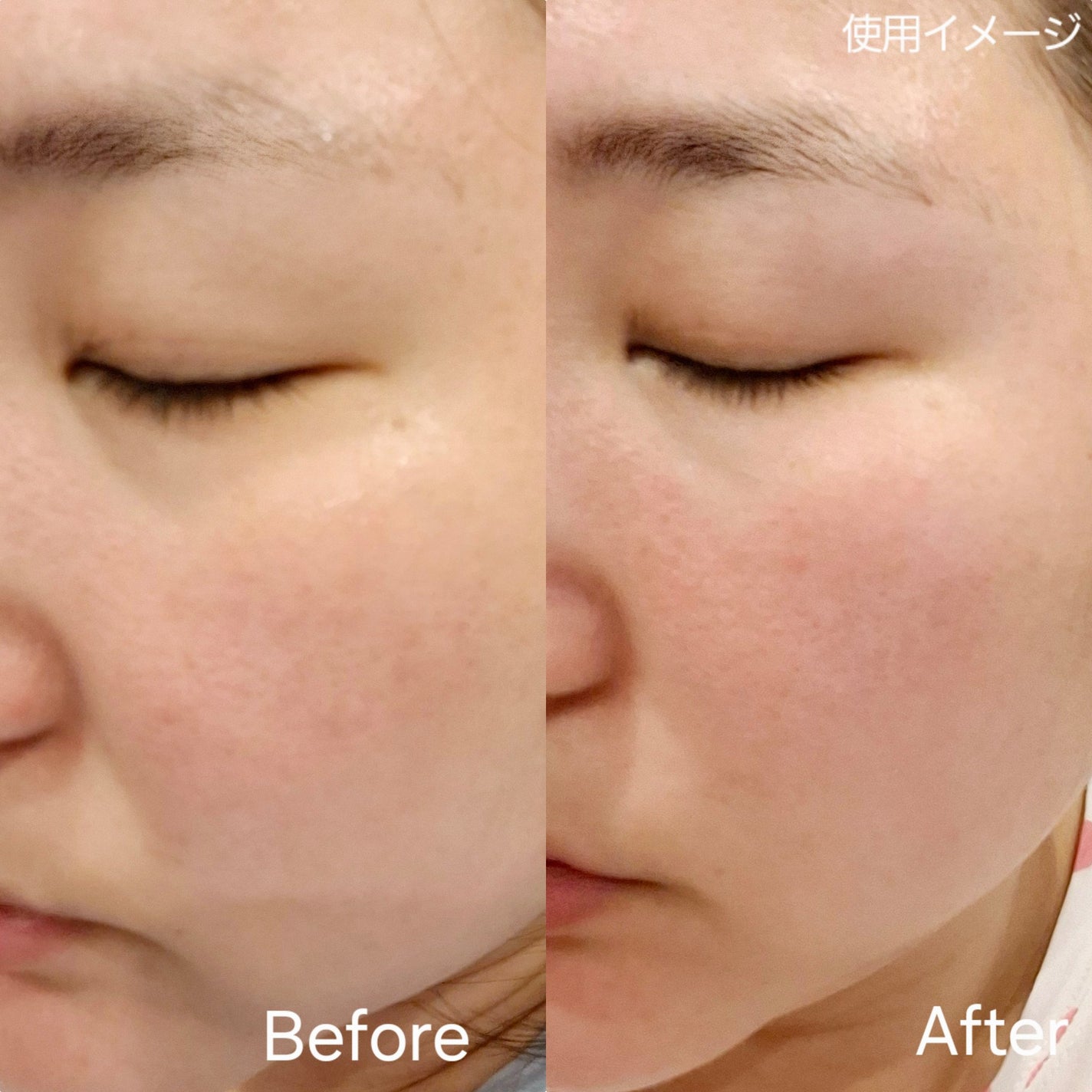 レッドモチセラム30/アレンシア/美容液を使ったクチコミ(3枚目)