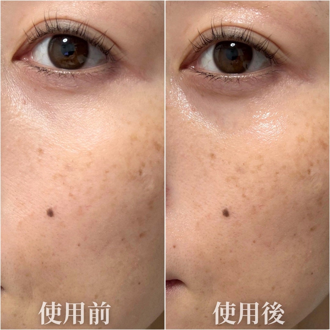 エクシードリミット DG セラム/IN SEVEN/美容液を使ったクチコミ(5枚目)