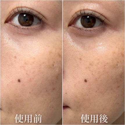 エクシードリミット DG セラム/IN SEVEN/美容液を使ったクチコミ(5枚目)