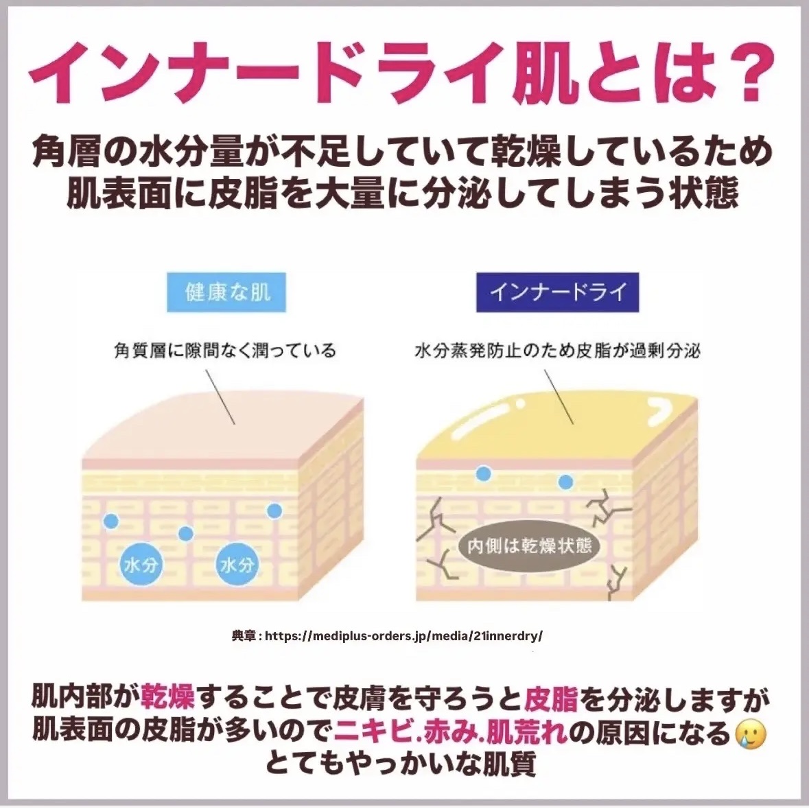 エクストリームエッセンストナーオリジナル/Real Barrier/化粧水を使ったクチコミ（2枚目）