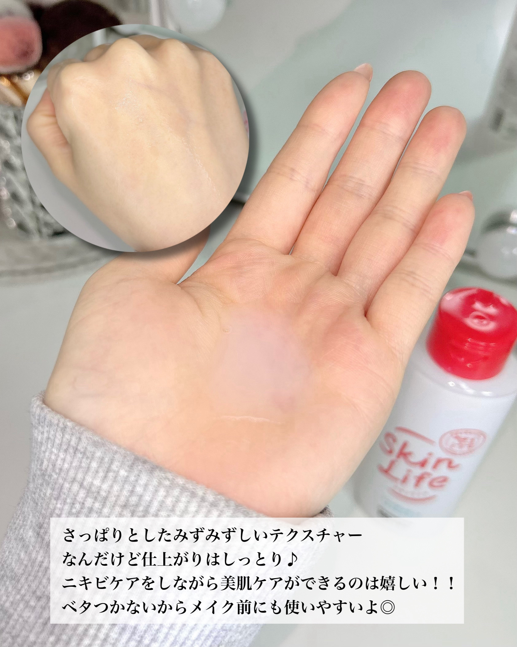 薬用化粧水/スキンライフ/化粧水を使ったクチコミ（3枚目）