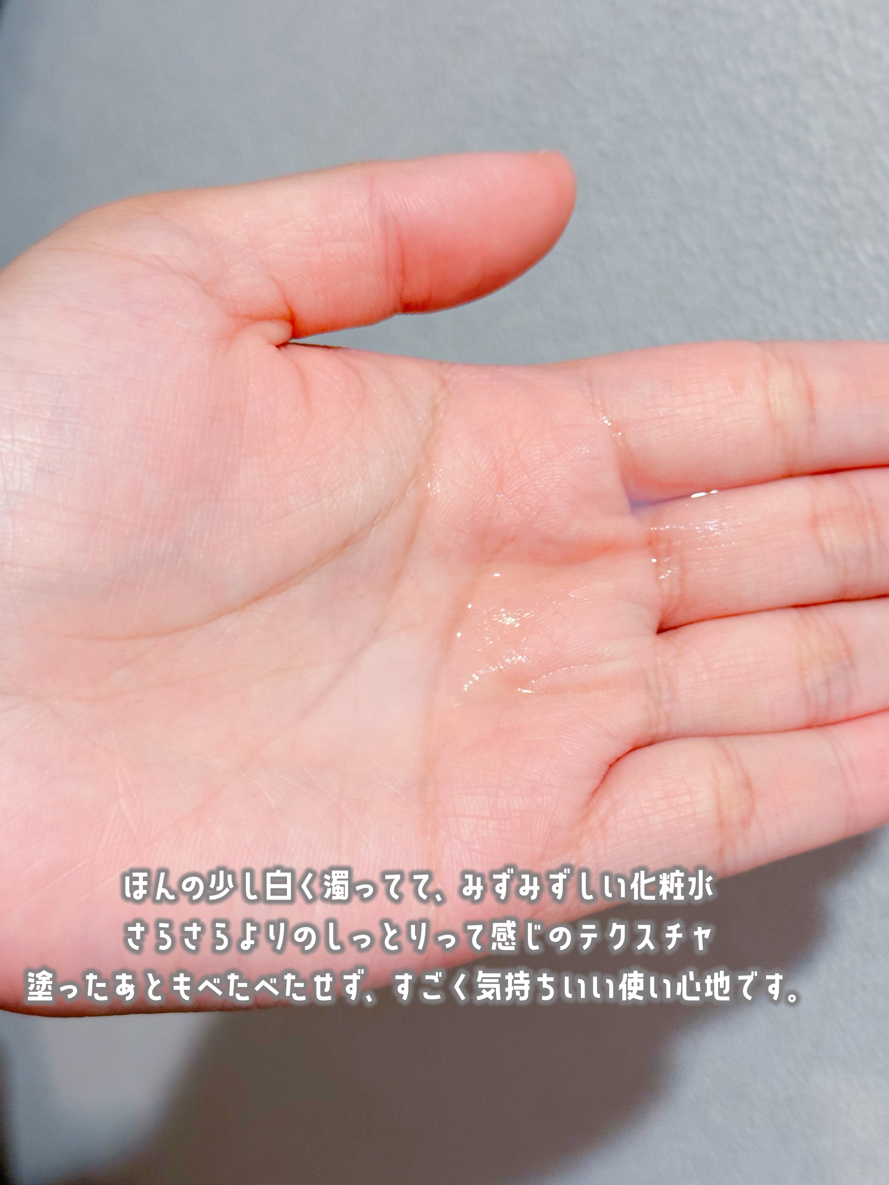 薬用化粧水/スキンライフ/化粧水を使ったクチコミ（2枚目）