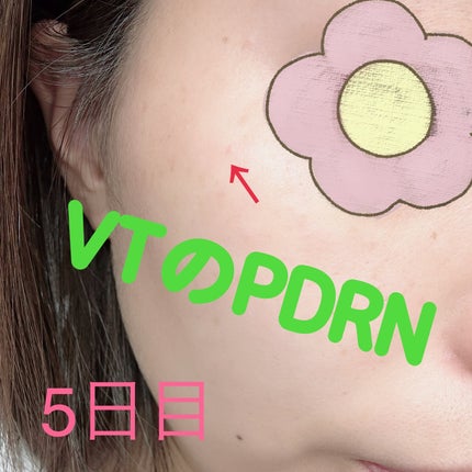 えりゅたん@がんばれない on LIPS 「7日間ツヤ肌チャレンジ‼️VTから出ているPDRNシリーズのパ..」(5枚目)