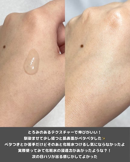 NDSポイントショット2000アンプル/ISOI/美容液を使ったクチコミ(4枚目)