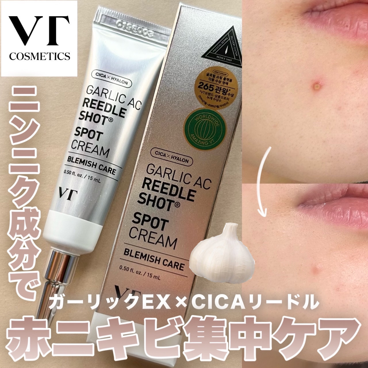 値下げ）ニキビ対策に新品リードルショットPRO100、シカクリーム、ロゼット+α vt リードルショット 100 リードル ショット ニードル