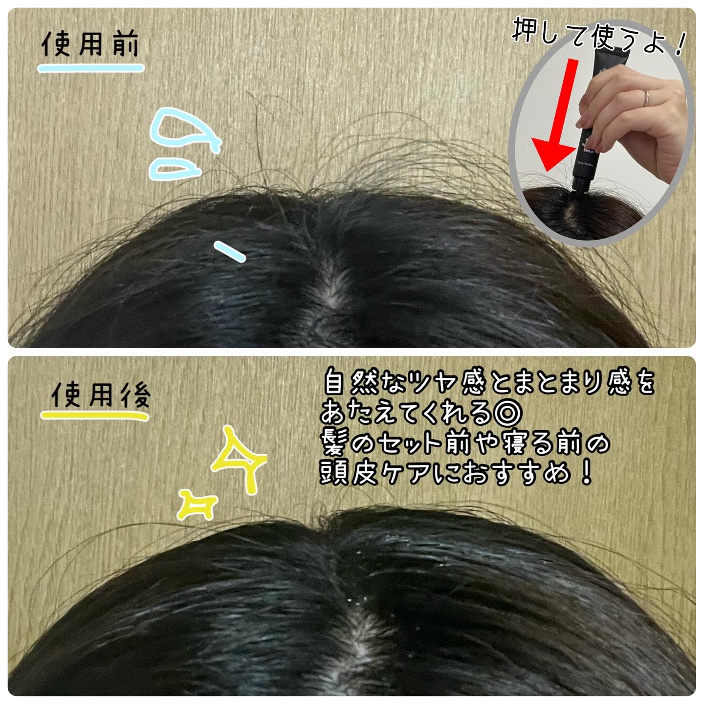 ドリームヘアブースターセラム/RayMoon/頭皮ローションを使ったクチコミ（3枚目）