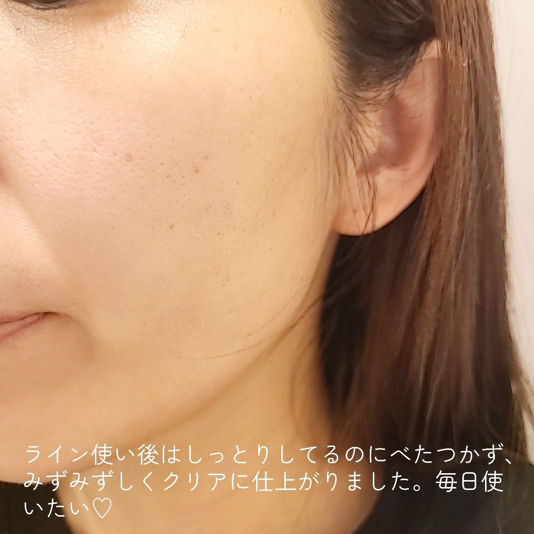 ディープ メラケア 美容液/Mildlab/美容液を使ったクチコミ(5枚目)