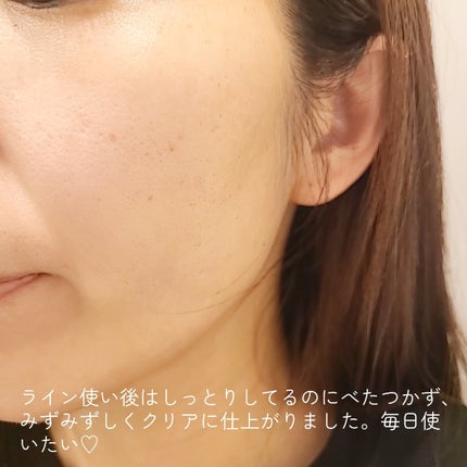 ディープ メラケア 美容液/Mildlab/美容液を使ったクチコミ(5枚目)