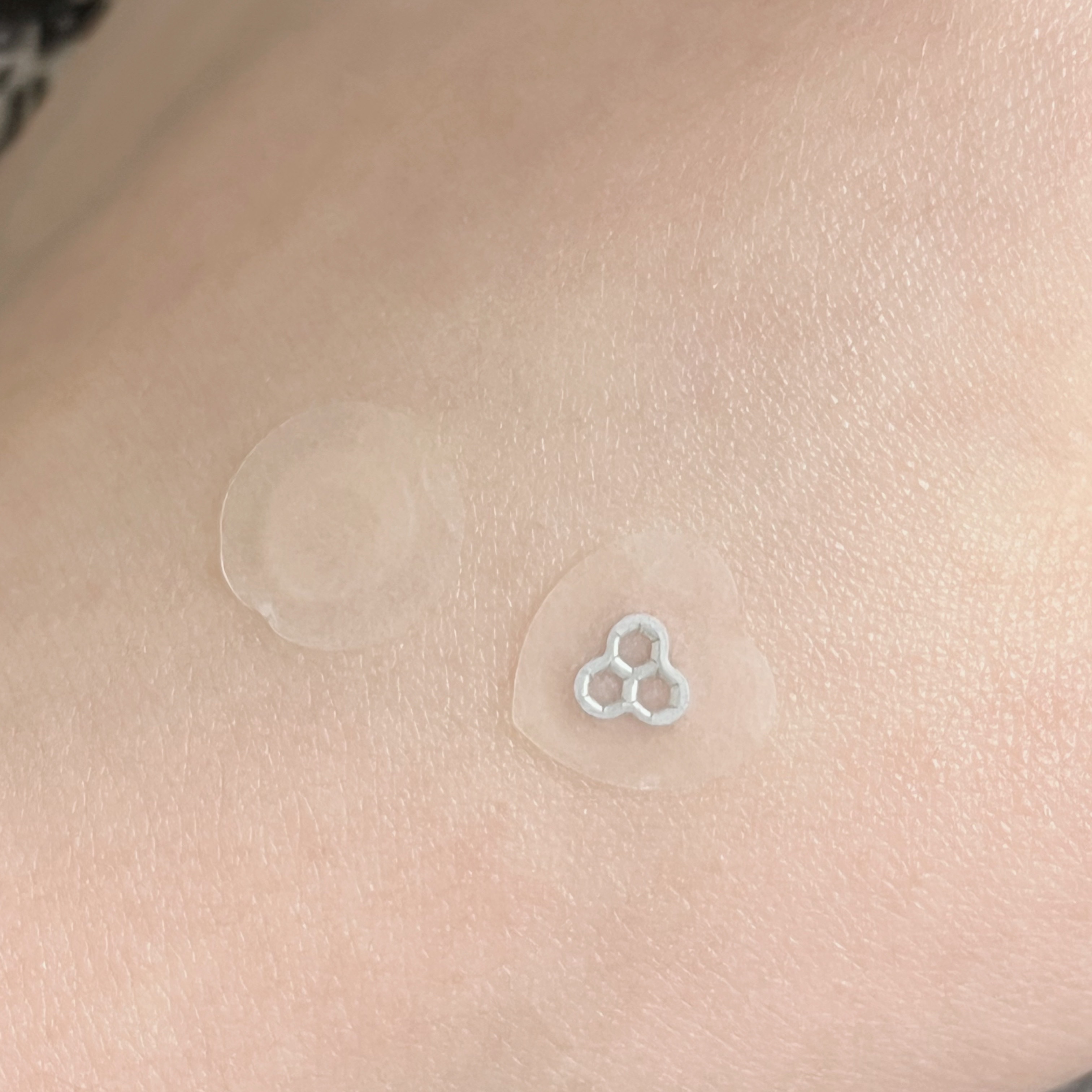 ACマグネシウムパッチ/スノーツープラス/シートマスク・パックを使ったクチコミ（3枚目）