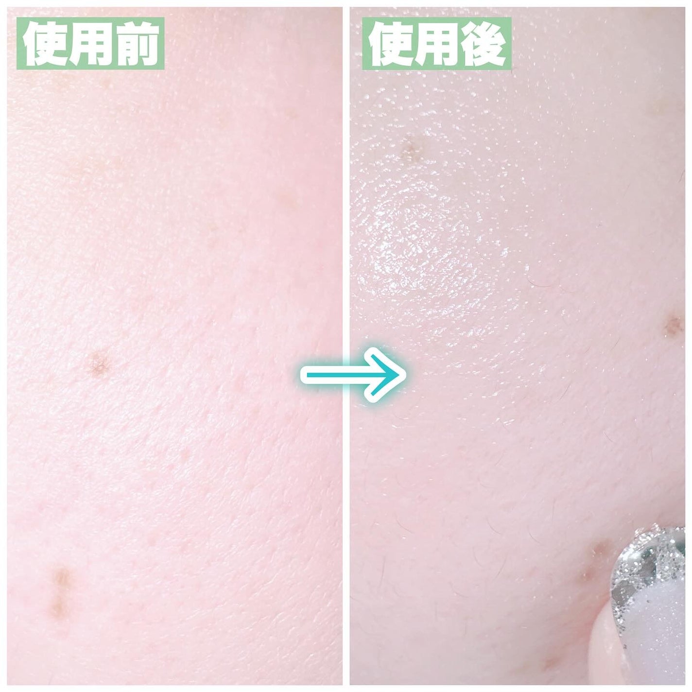 リードルS PDRN+ セラム/VT/美容液を使ったクチコミ(5枚目)