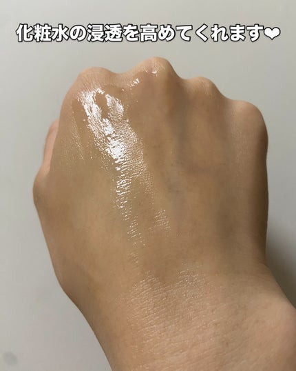 炭酸ムースセラム/chant a charm /美容液を使ったクチコミ(5枚目)