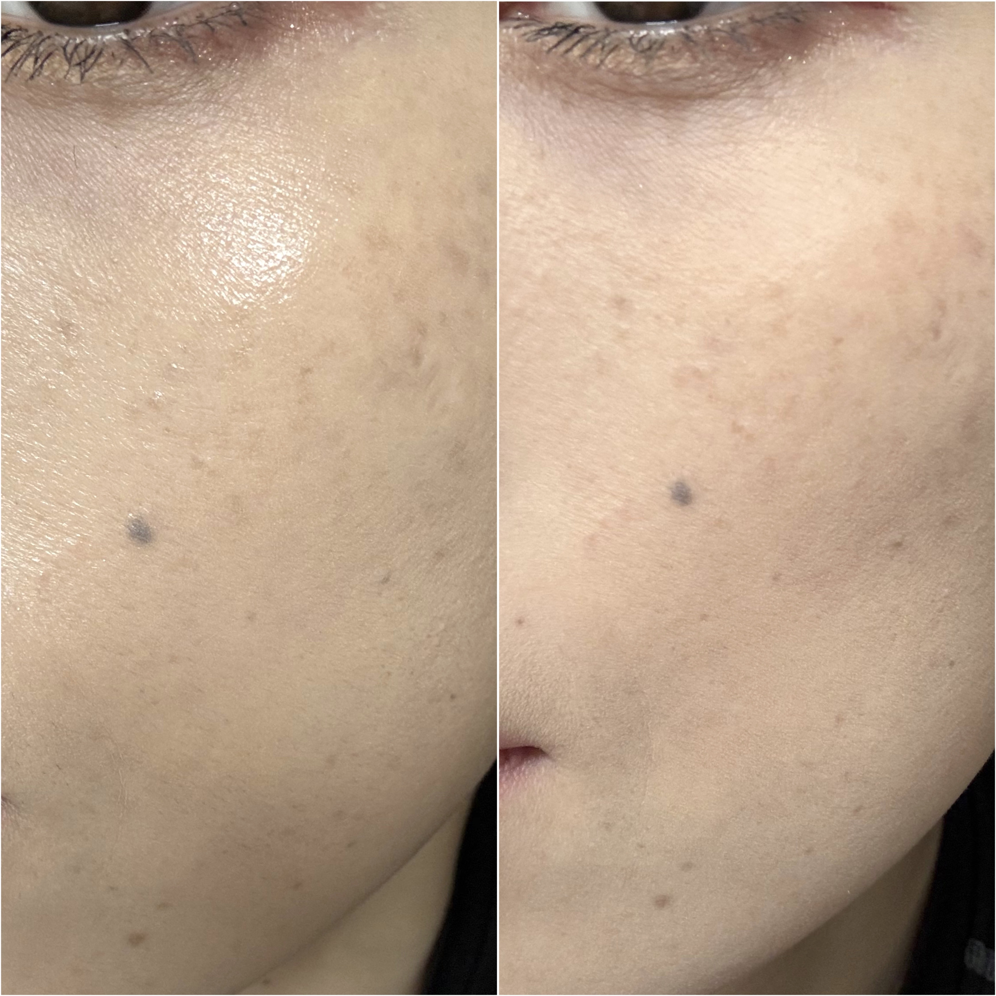 メイク キープ パウダー EX/コーセーコスメニエンス/ルースパウダーを使ったクチコミ（3枚目）