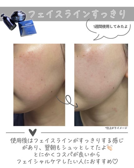 インモトックス小顔リフトアップペプチドショットクリーム&吸引ジェット/MEDITHERAPY/フェイスクリームを使ったクチコミ(5枚目)