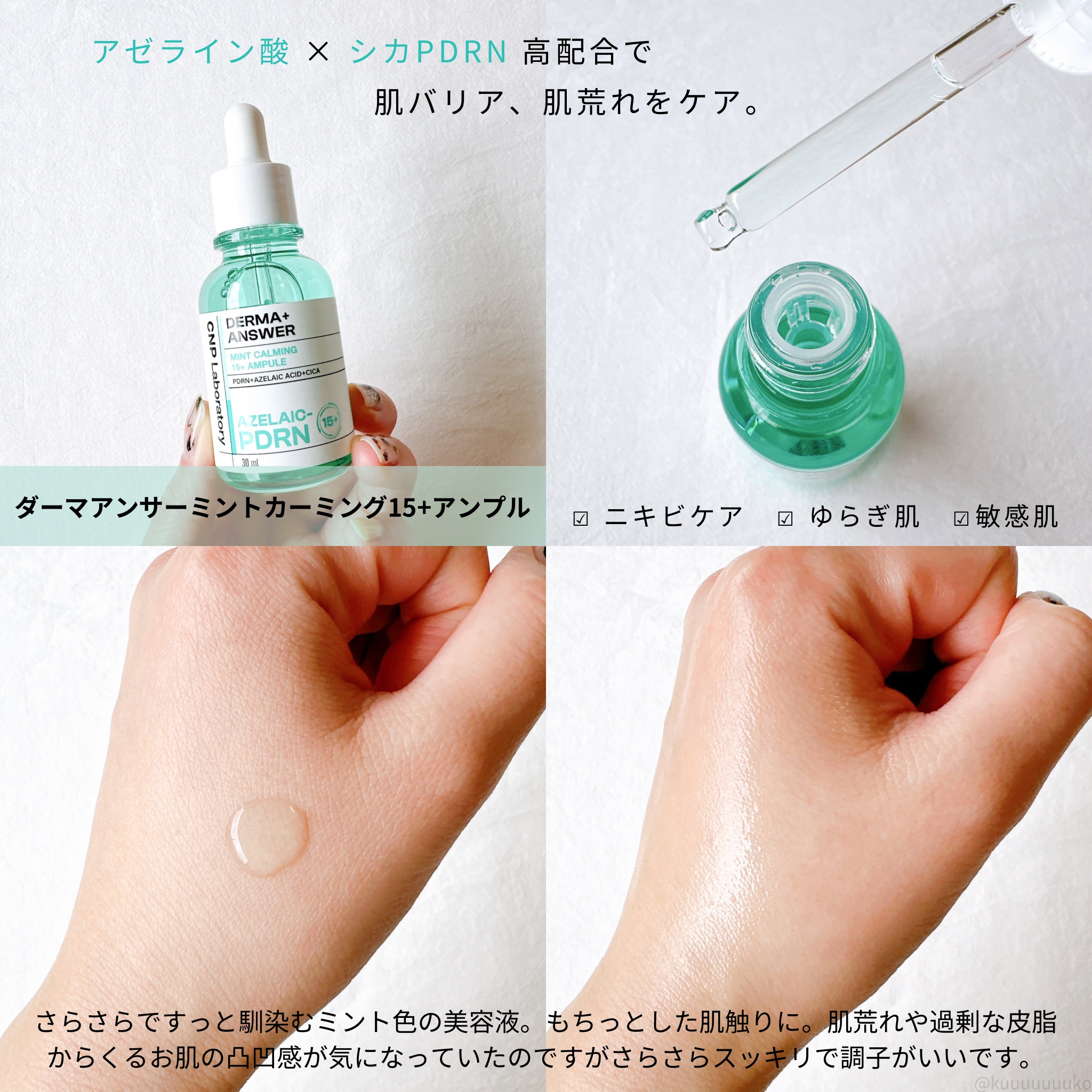 ダーマアンサーアゼライン酸ミントアンプル/CNP Laboratory/美容液を使ったクチコミ（2枚目）
