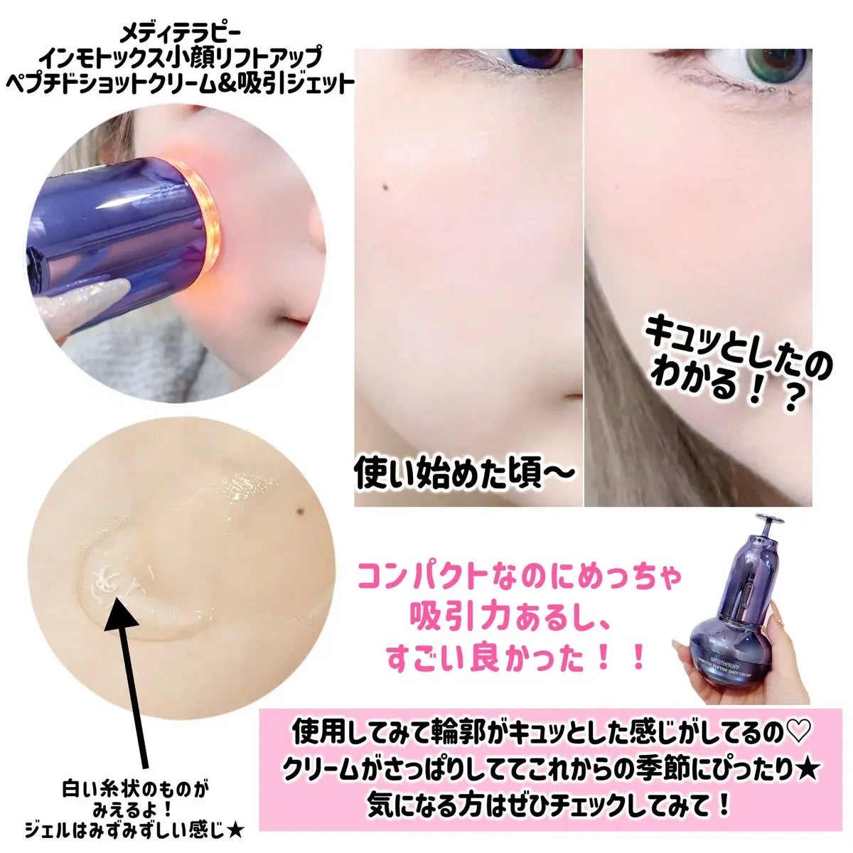インモトックス小顔リフトアップペプチドショットクリーム&吸引ジェット/MEDITHERAPY/フェイスクリームを使ったクチコミ(4枚目)
