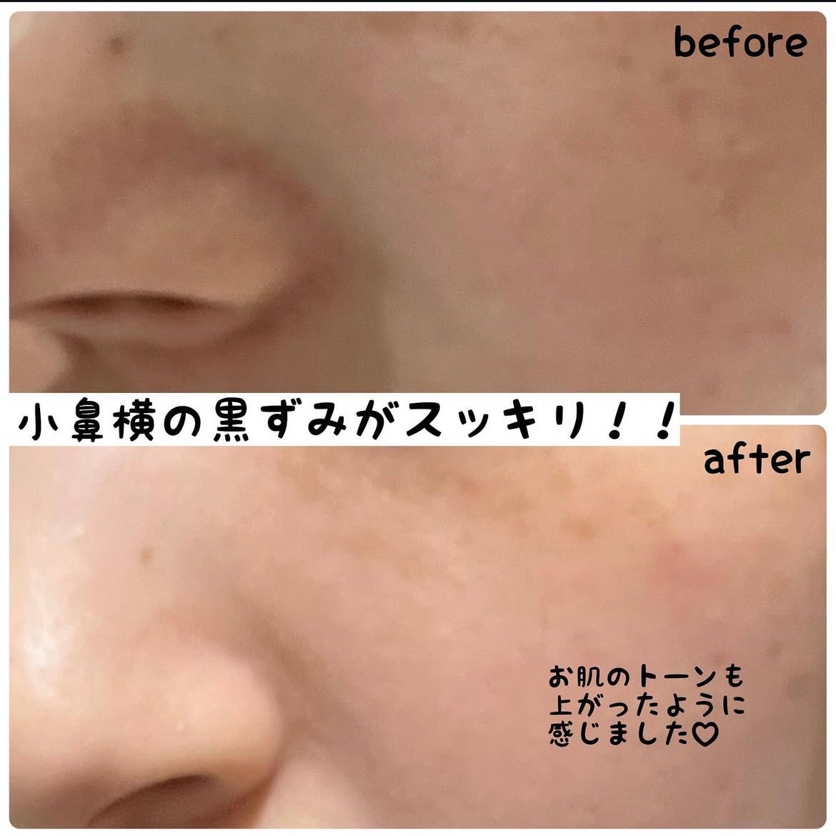 アレンシアフレッシュもちソープ「ロイヤルローズヒップ」/アレンシア/その他洗顔料を使ったクチコミ(3枚目)