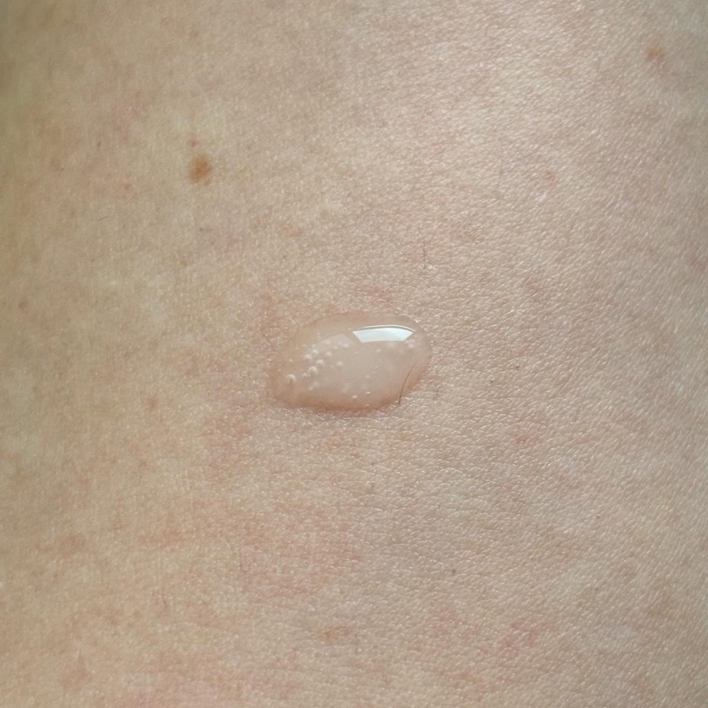 アルティミューン™ パワライジング セラム/SHISEIDO/美容液を使ったクチコミ(4枚目)