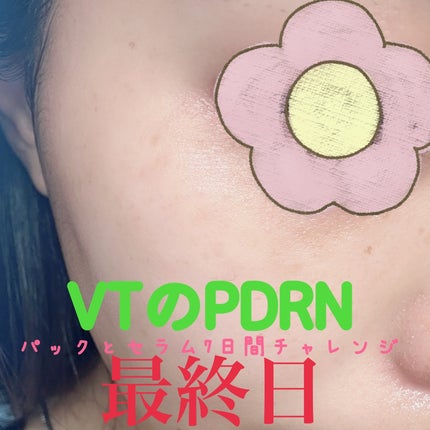 えりゅたん@がんばれない on LIPS 「7日間ツヤ肌チャレンジ‼️VTから出ているPDRNシリーズのパ..」(7枚目)