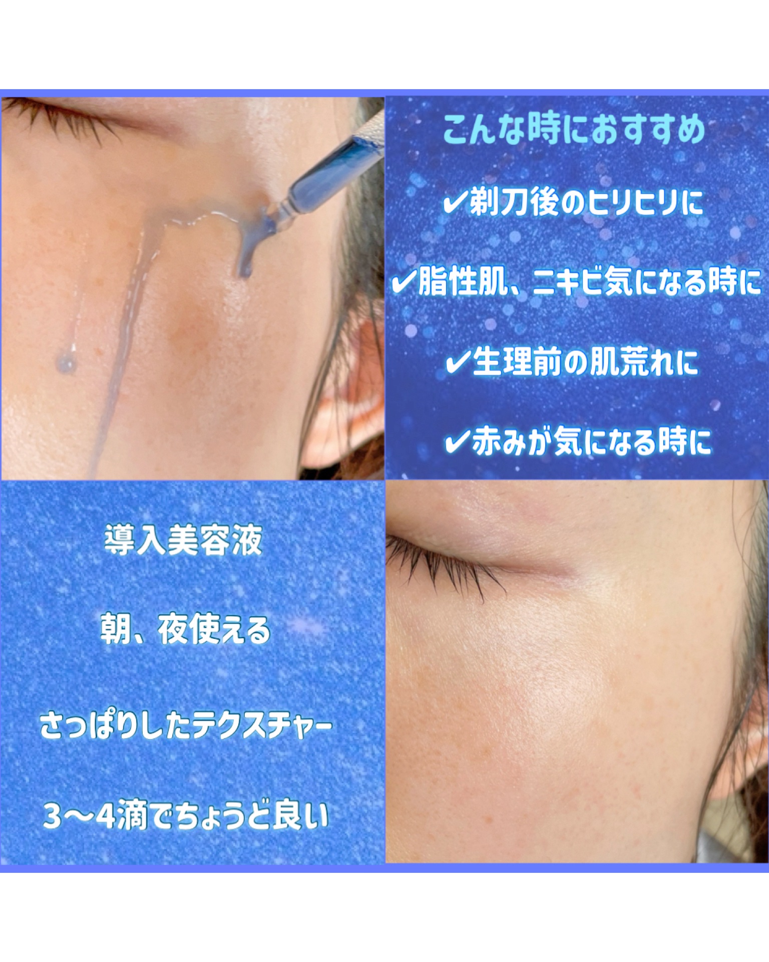 ミッドナイトブルーカーミングクリーム/Klairs/フェイスクリームを使ったクチコミ（3枚目）