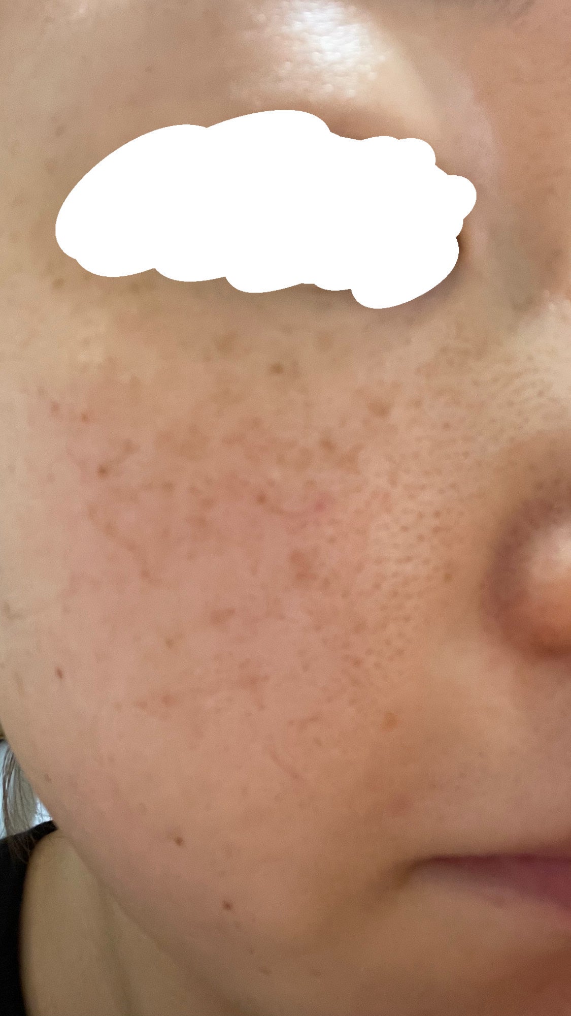 RXザ・ビタミンC23セラム/COSRX/美容液を使ったクチコミ(1枚目)