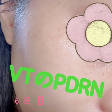 えりゅたん@がんばれない on LIPS 「7日間ツヤ肌チャレンジ‼️VTから出ているPDRNシリーズのパ..」(6枚目)