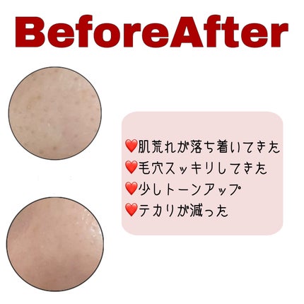 A1カーミング アンプル/VT/美容液を使ったクチコミ(2枚目)