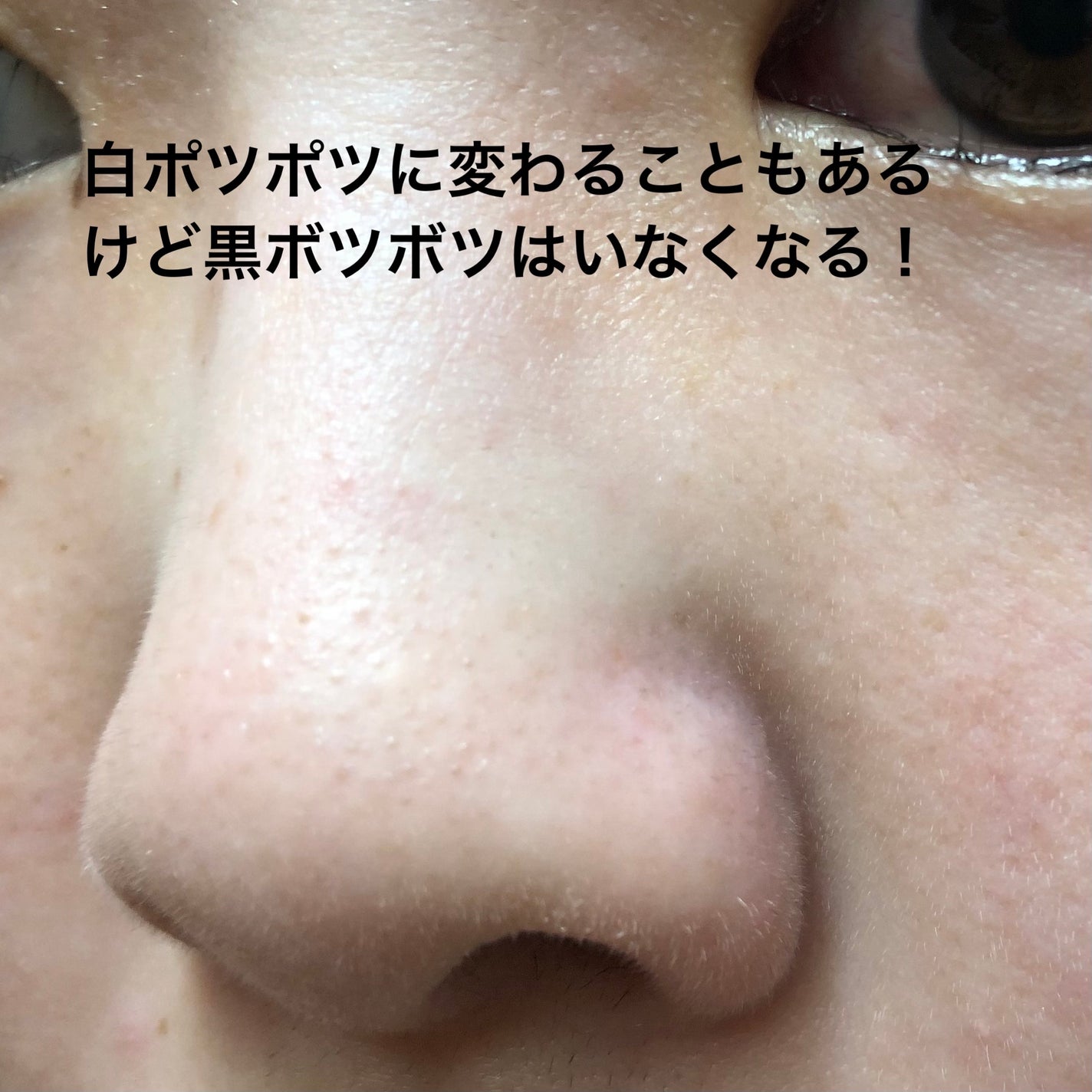 ディープクリア洗顔パウダー/ファンケル/洗顔パウダーを使ったクチコミ(3枚目)