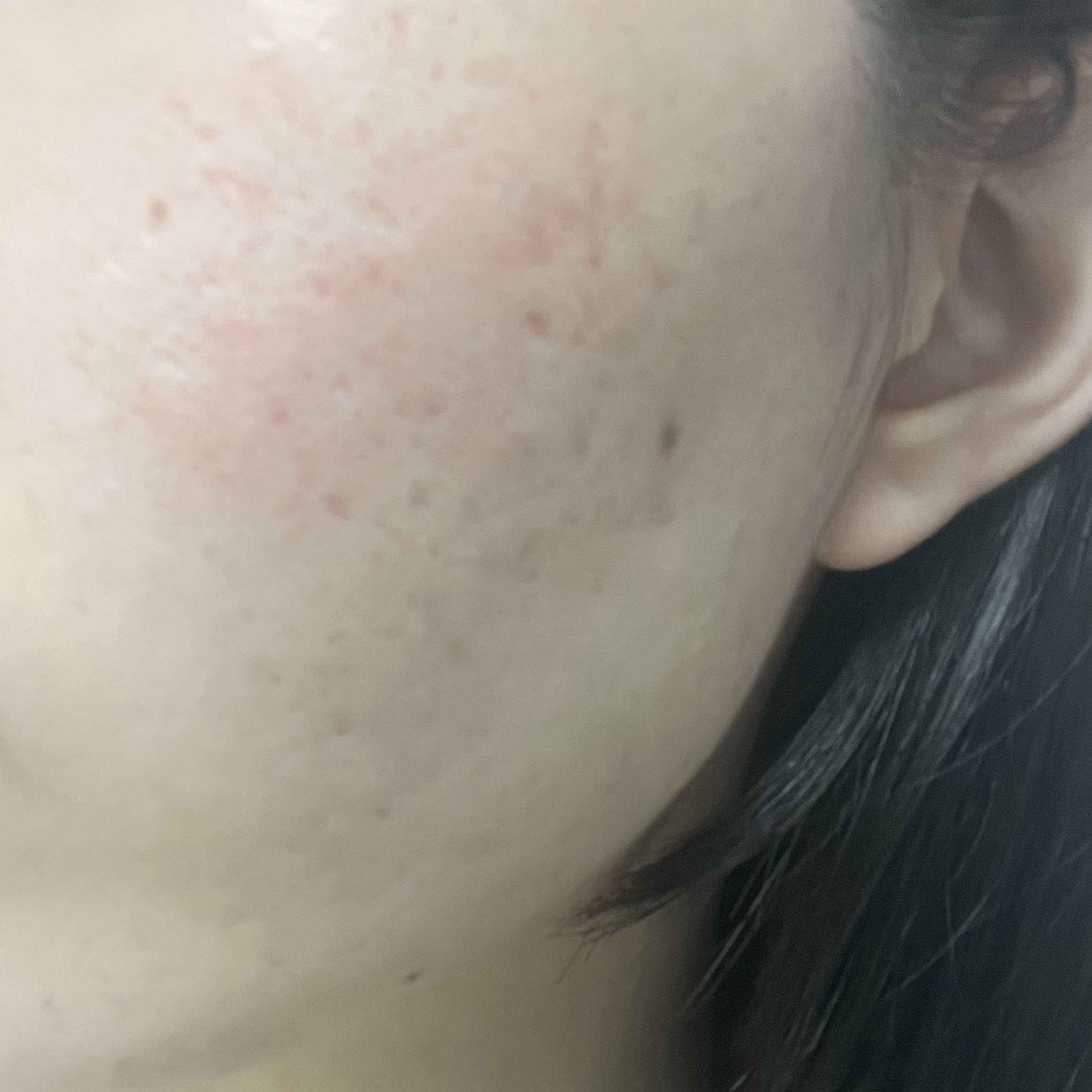 カラミー カラミンノーセバムローション/Calamee/化粧水を使ったクチコミ（3枚目）