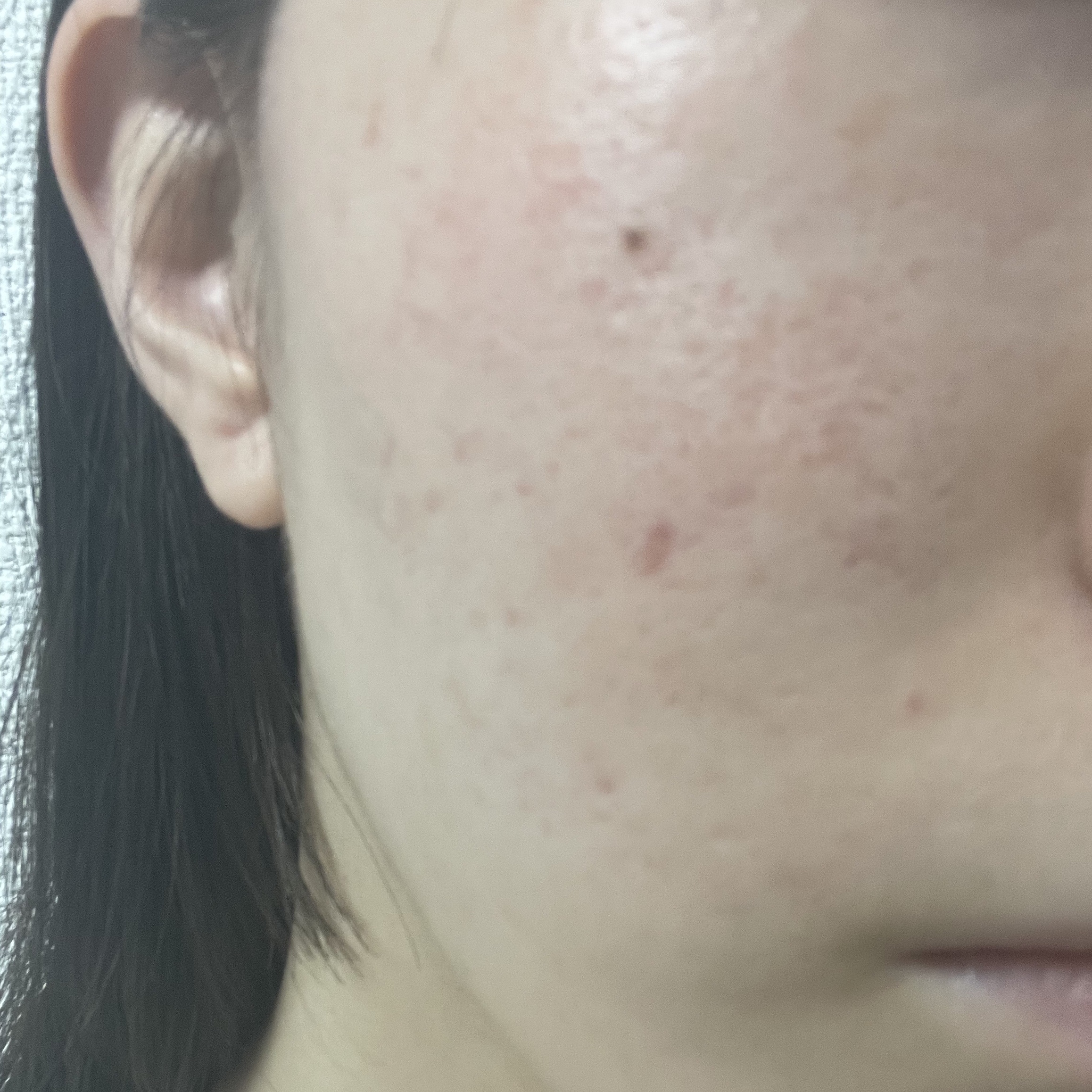 カラミー カラミンノーセバムローション/Calamee/化粧水を使ったクチコミ（2枚目）