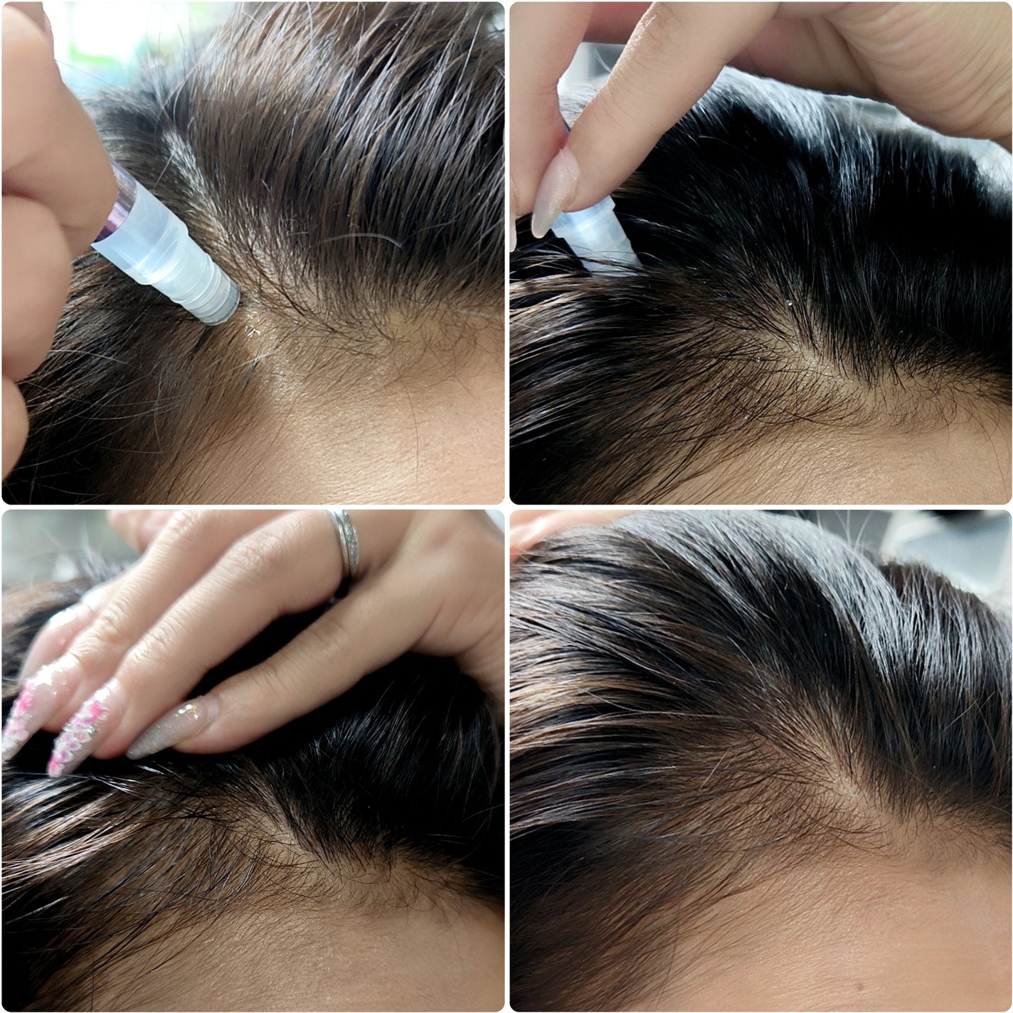 バイオグロウナインショット/SAVON de SIESTA/頭皮ローションを使ったクチコミ(4枚目)