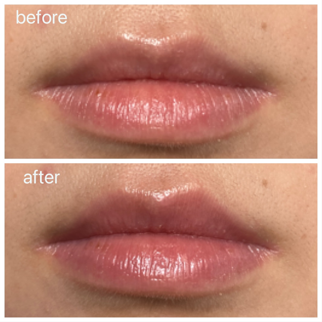 アンシーン バルーンティント/Oddtype/リップティントを使ったクチコミ（3枚目）