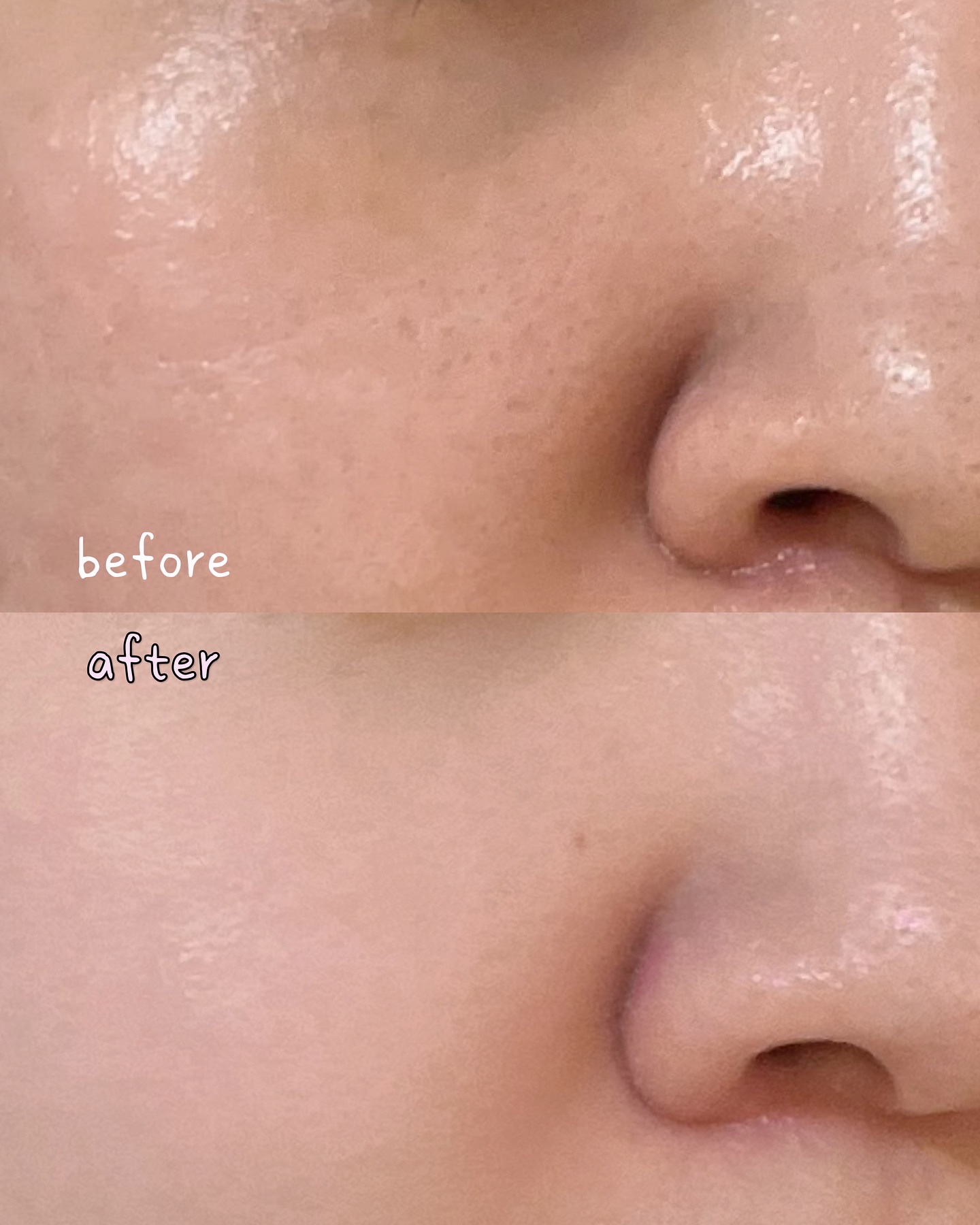 アレンシアフレッシュもちソープ「ロイヤルローズヒップ」/アレンシア/その他洗顔料を使ったクチコミ（1枚目）