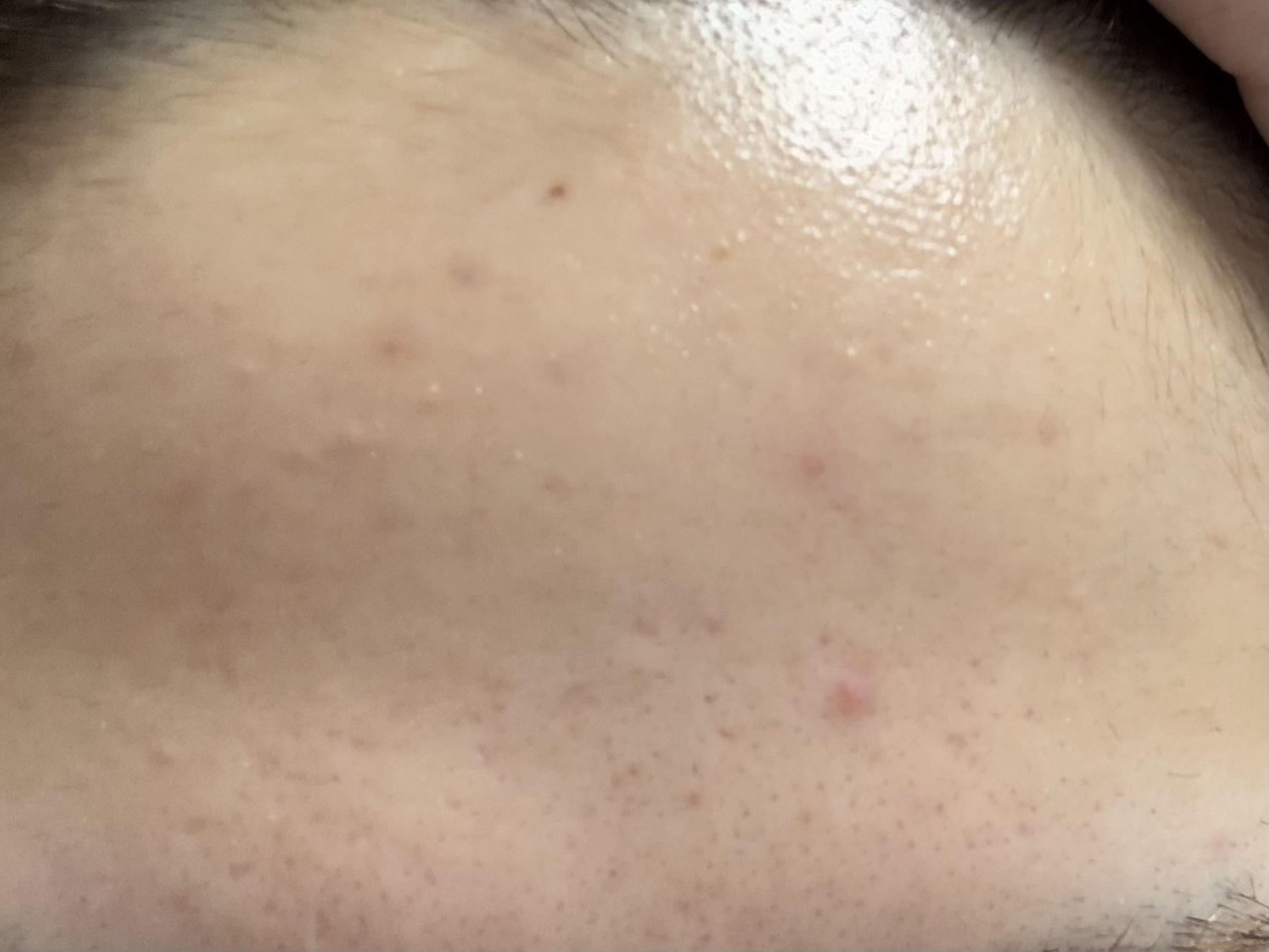 潤浸保湿 化粧水 III とてもしっとり/キュレル/化粧水を使ったクチコミ（3枚目）