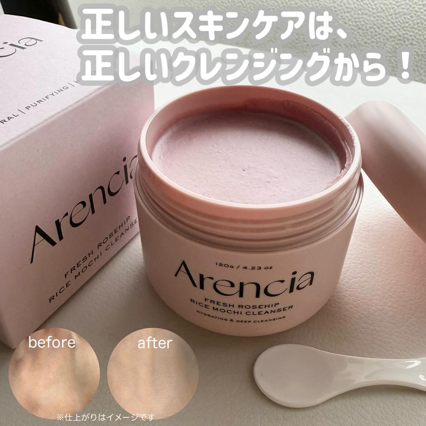 アレンシアフレッシュもちソープ「ロイヤルローズヒップ」/アレンシア/その他洗顔料を使ったクチコミ（1枚目）