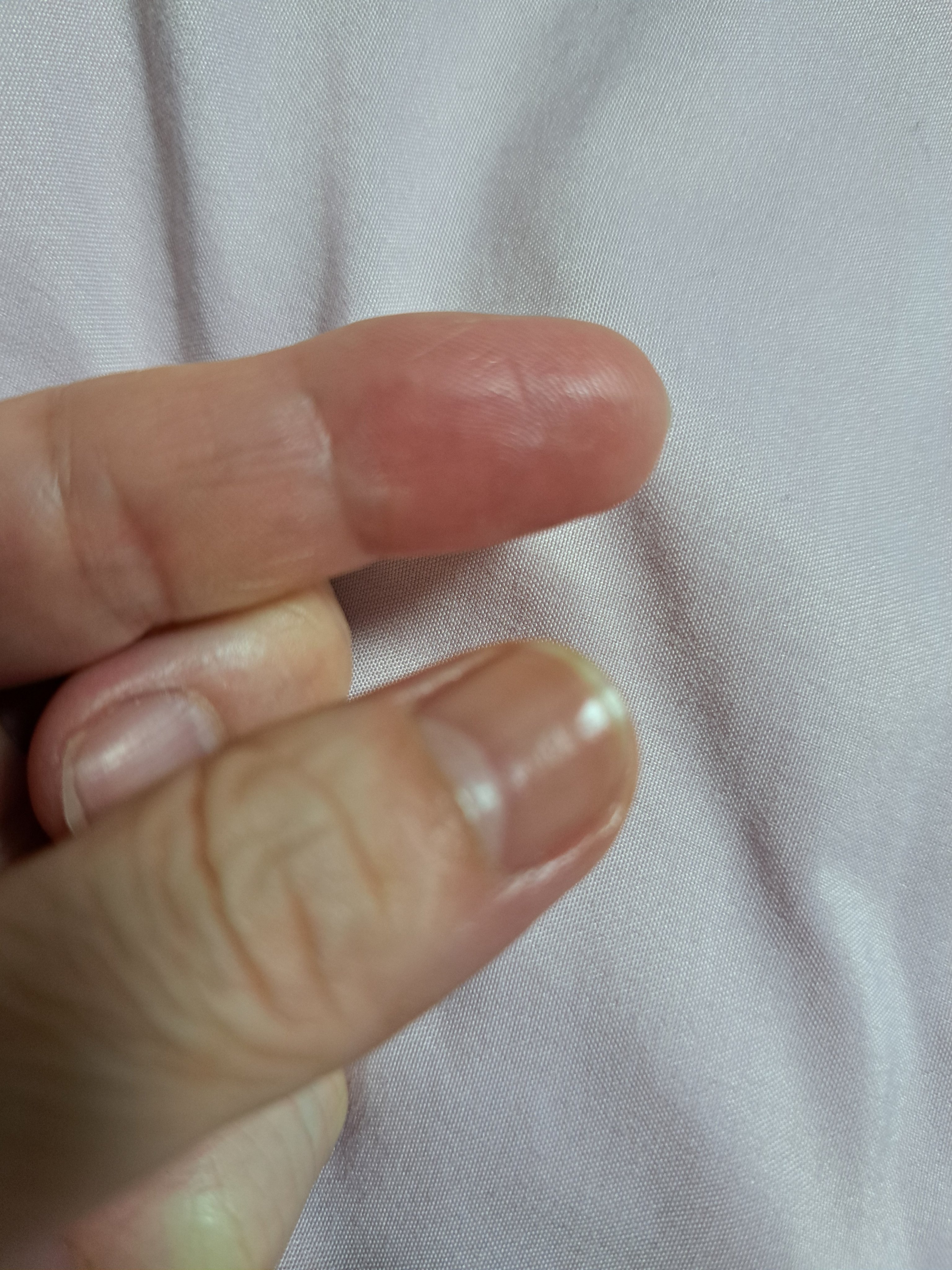 エッセンスネイルオイル/excel/ネイルオイル・トリートメントを使ったクチコミ（3枚目）