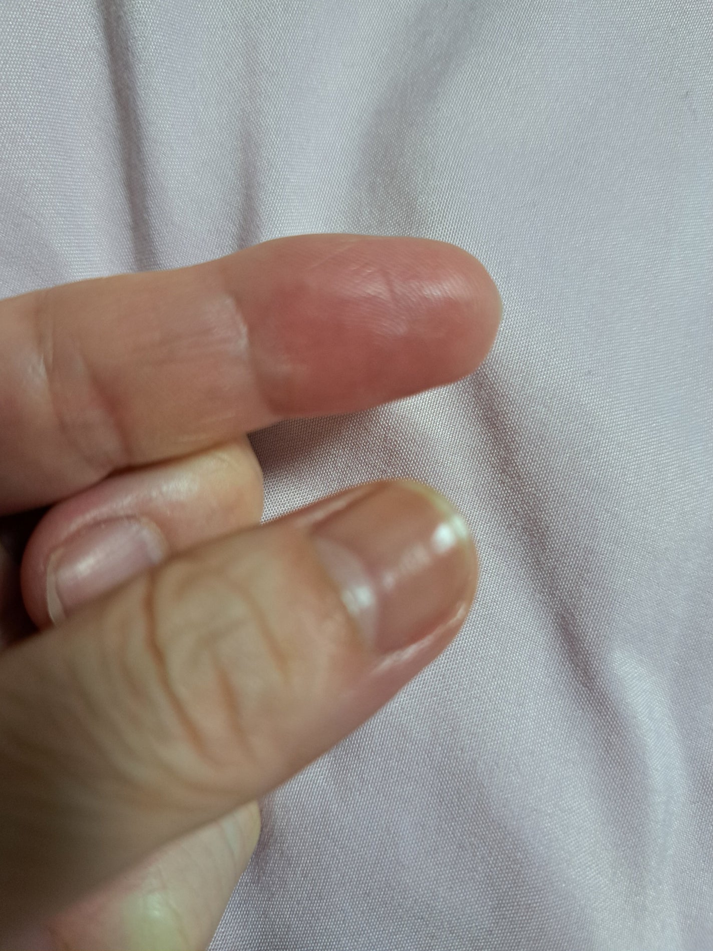 エッセンスネイルオイル/excel/ネイルオイル・トリートメントを使ったクチコミ(3枚目)