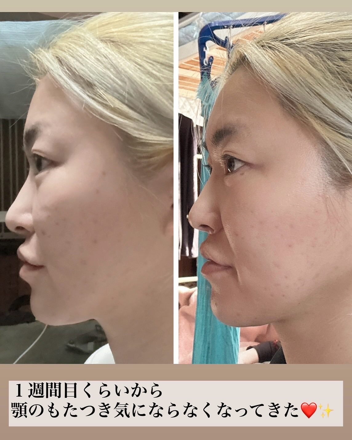 5児ママ ゆかこ♡フォロバ100 コメください on LIPS 「@meditherapy.jp様のプロモーションに参加していま..」(3枚目)