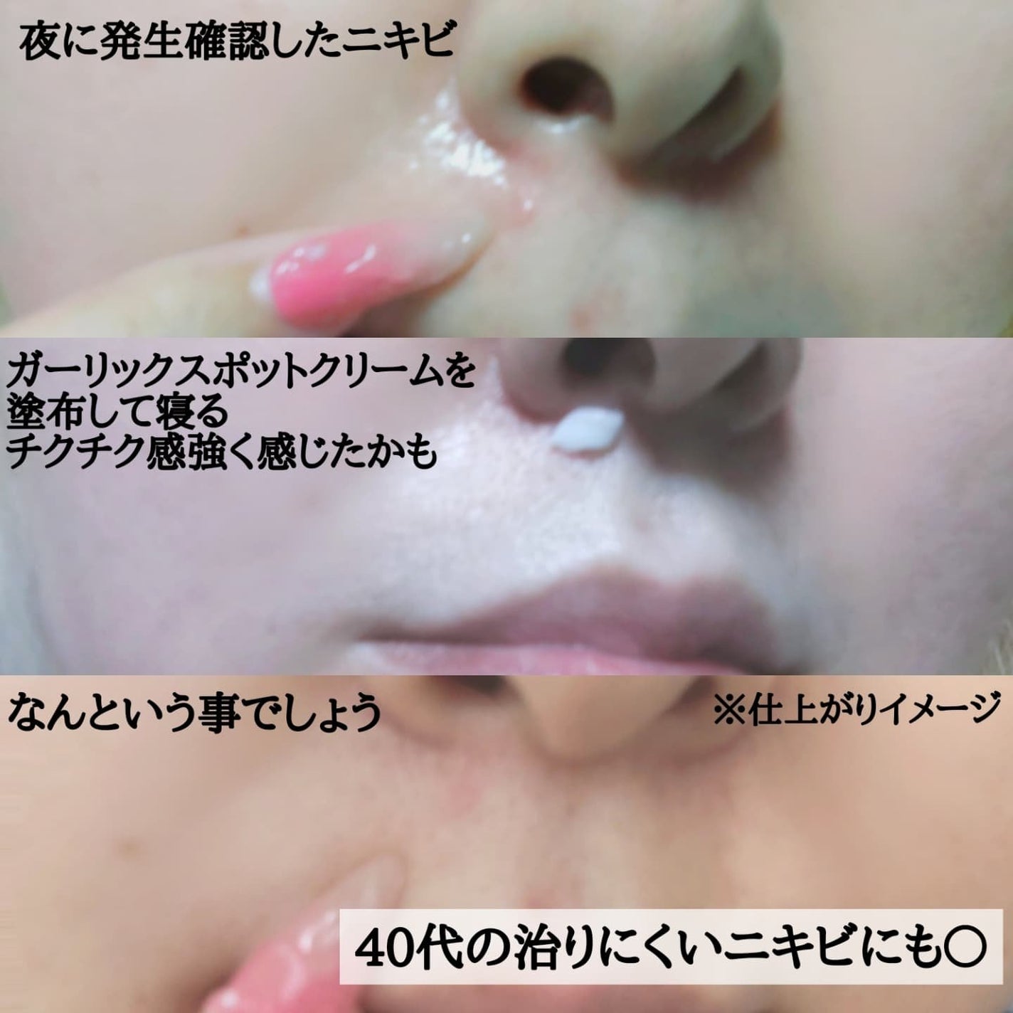 PDRN+ デイリーマスク/VT/シートマスク・パックを使ったクチコミ(10枚目)