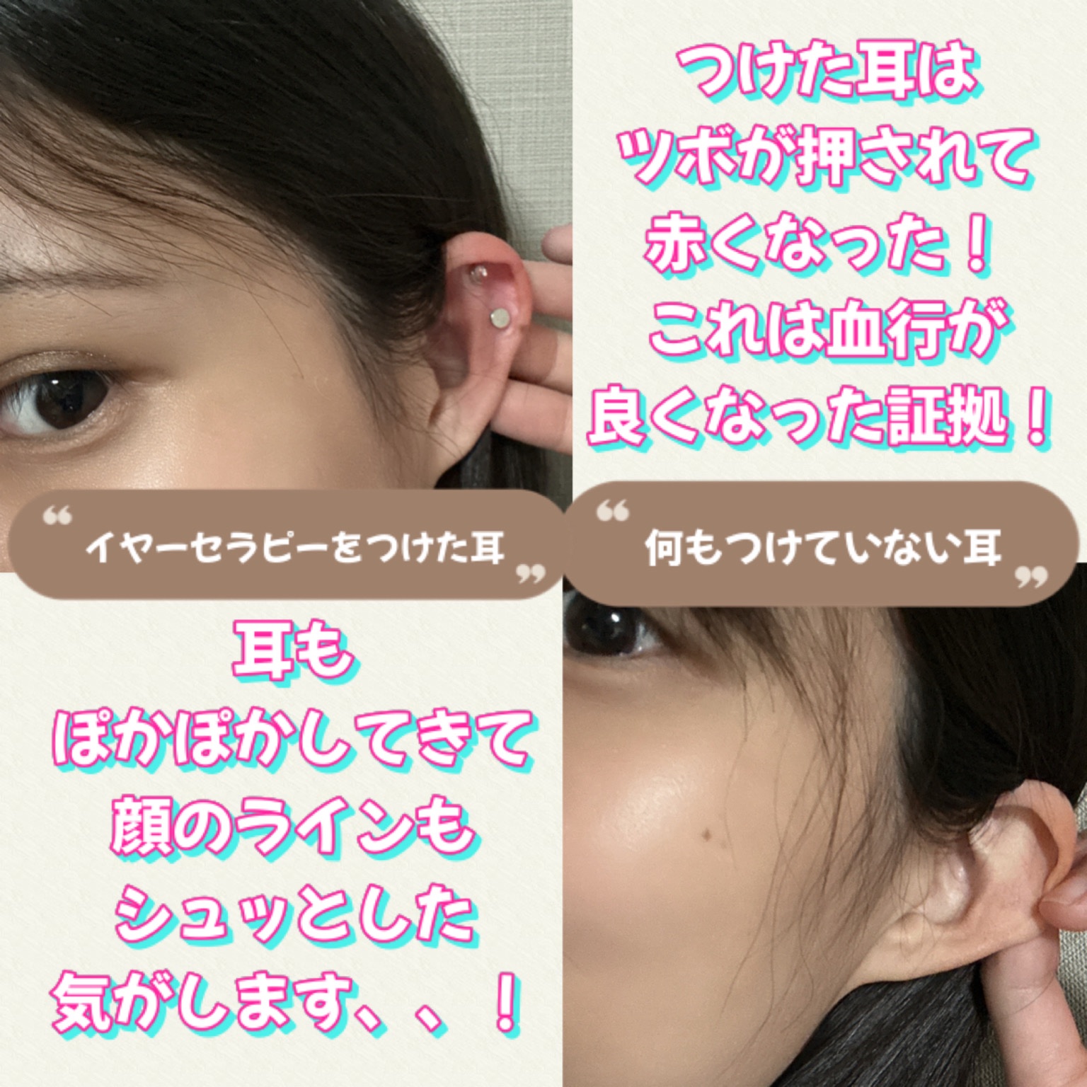 イヤーセラピー/RETURNITY/その他を使ったクチコミ（3枚目）