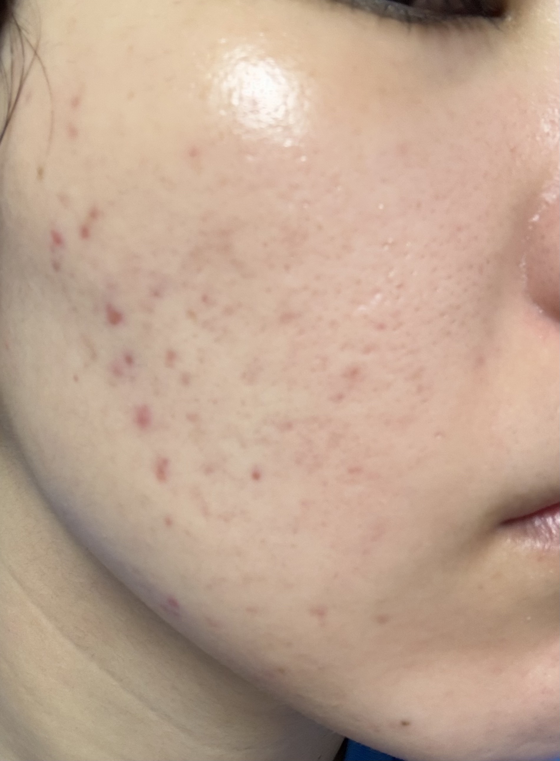 潤浸保湿 化粧水 III とてもしっとり/キュレル/化粧水を使ったクチコミ（1枚目）