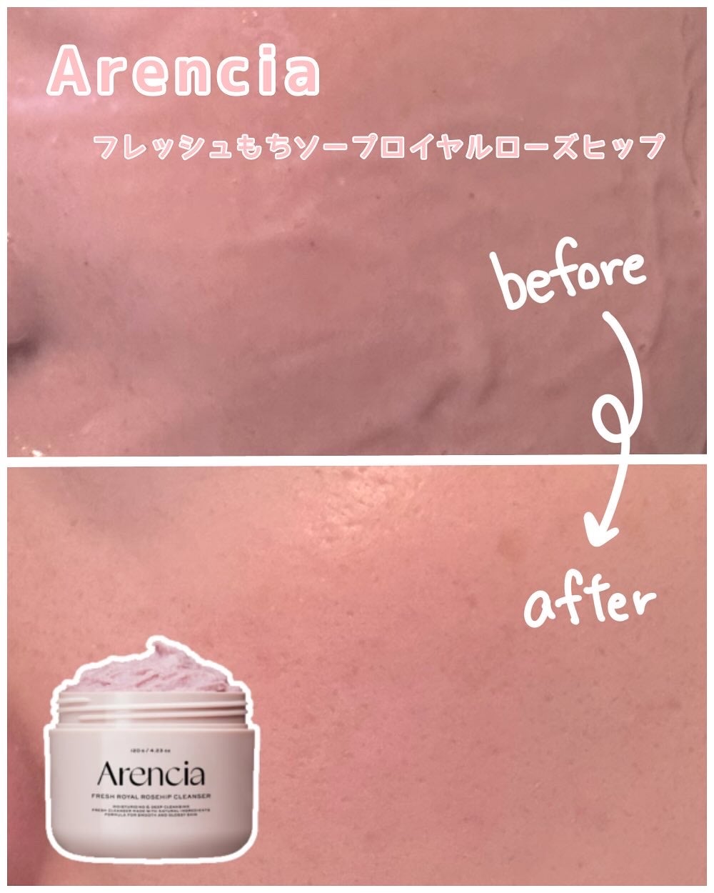 アレンシアフレッシュもちソープ「ロイヤルローズヒップ」/アレンシア/その他洗顔料を使ったクチコミ(1枚目)