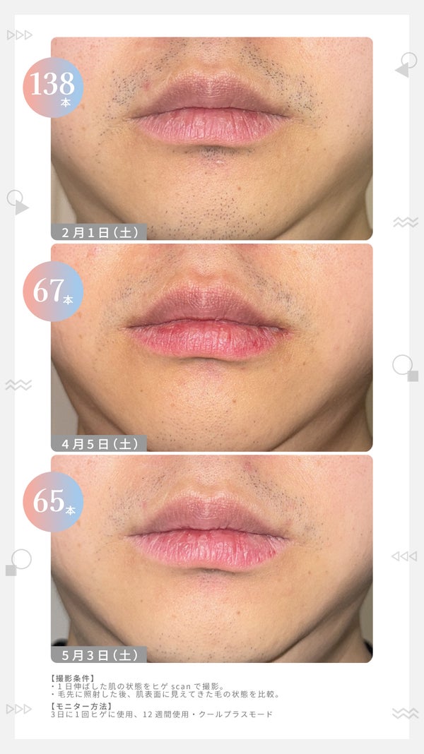 【パナソニック】LIPSユーザー"110名"が2ヶ月お試し!家庭用光美容器の実力はどう?の画像
