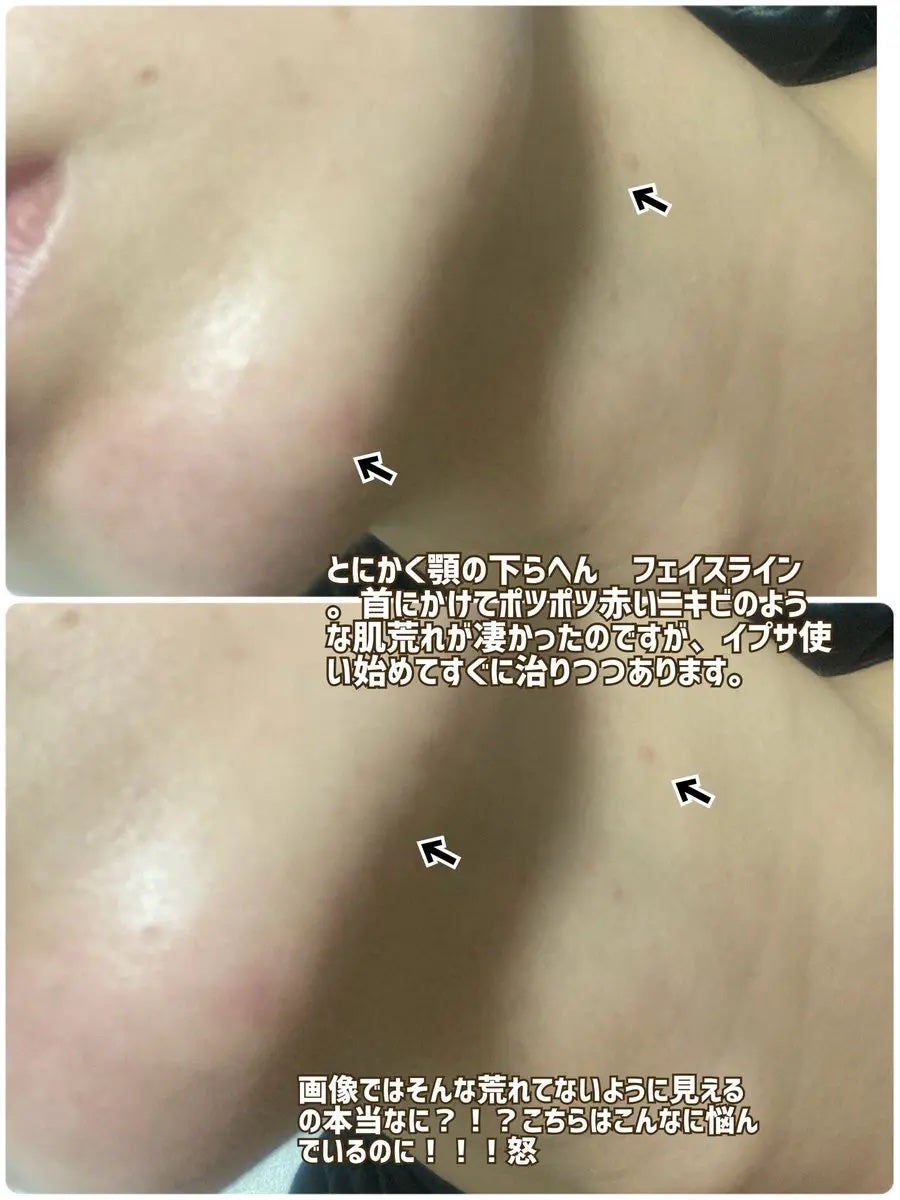 ザ・タイムR アクア/IPSA/化粧水を使ったクチコミ(4枚目)