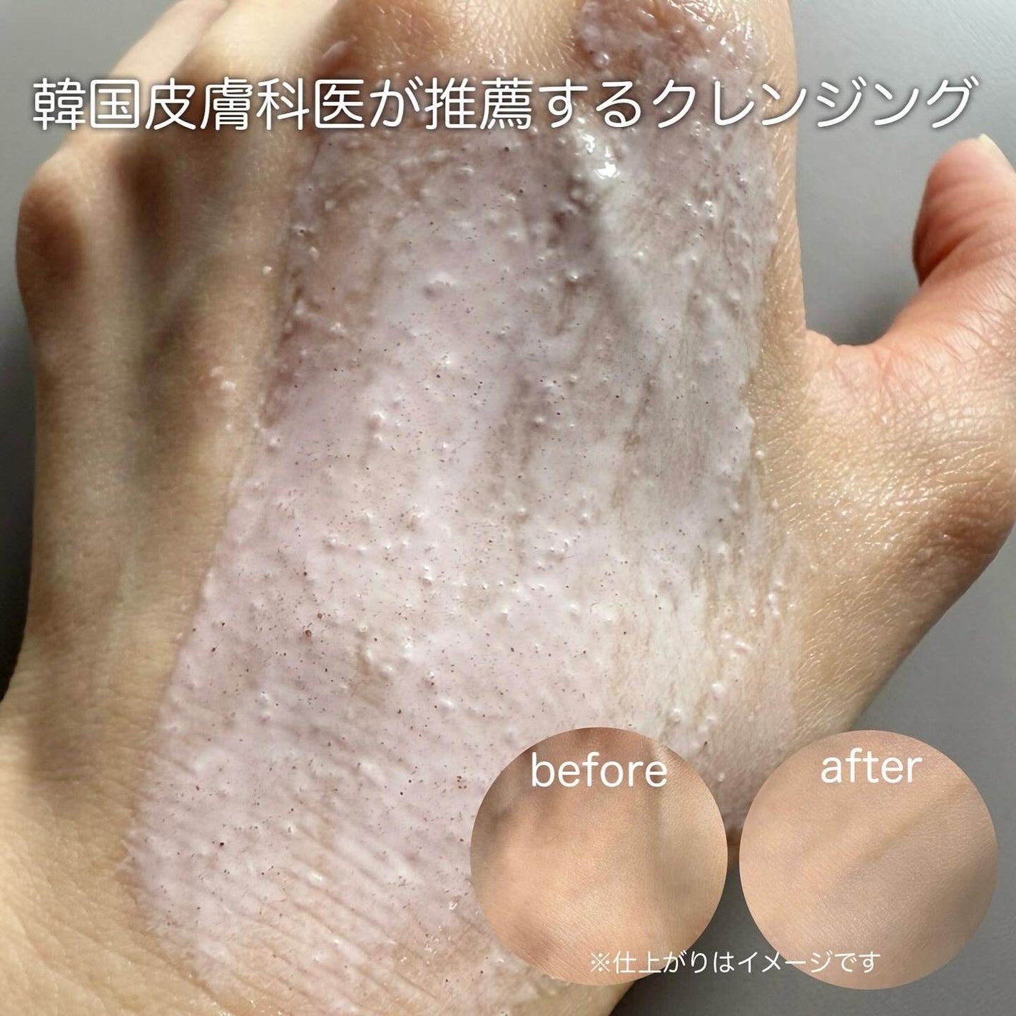 アレンシアフレッシュもちソープ「ロイヤルローズヒップ」/アレンシア/その他洗顔料を使ったクチコミ(2枚目)