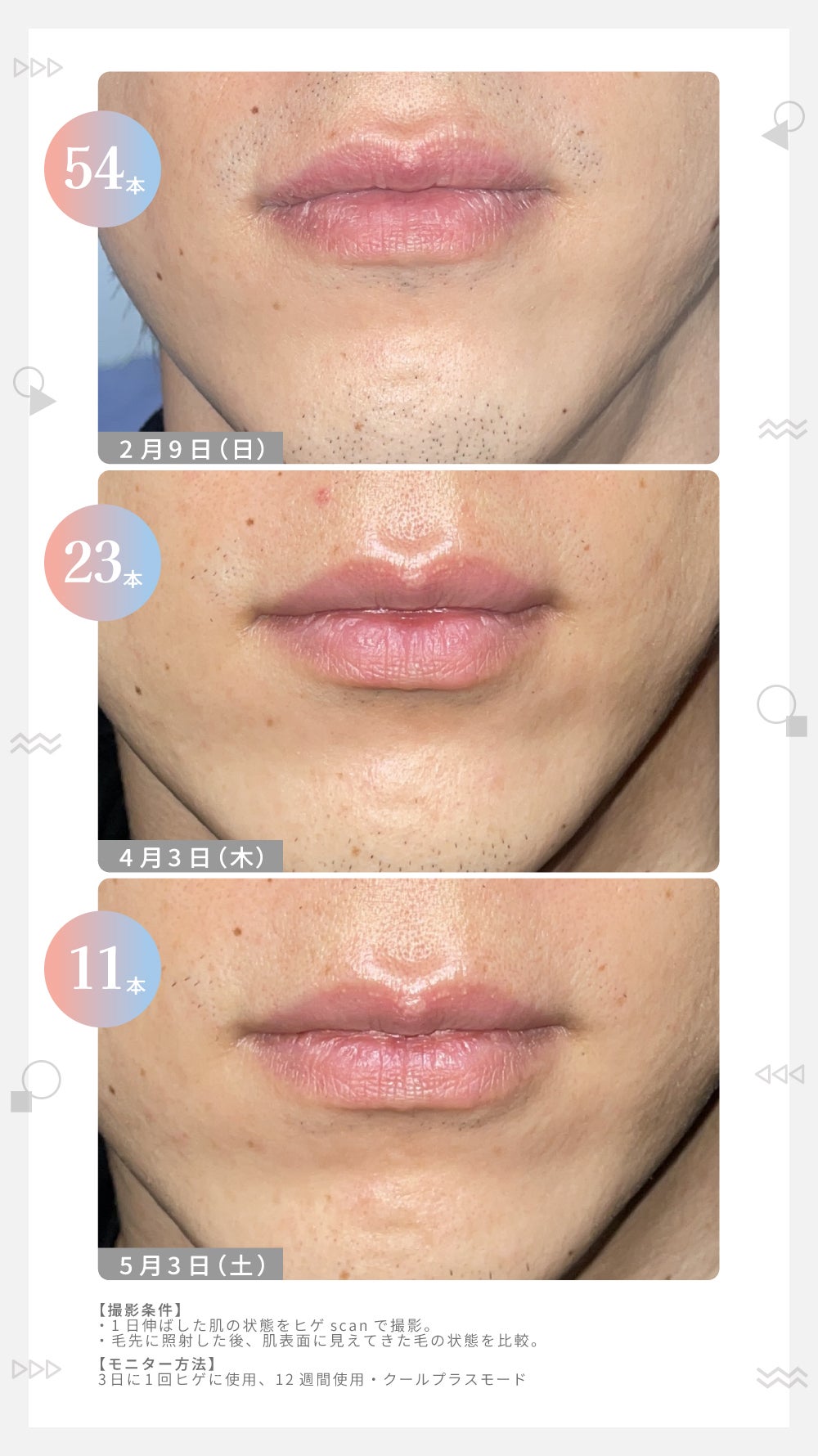 【パナソニック】LIPSユーザー"110名"が2ヶ月お試し!家庭用光美容器の実力はどう?の画像